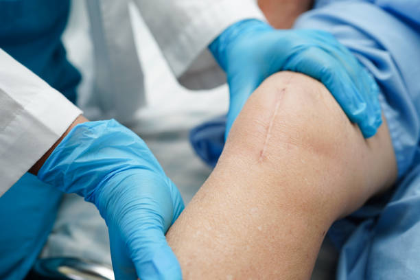 Best Hip Replacement Surgeon in Best Knee Replacement Surgeon in sangamner